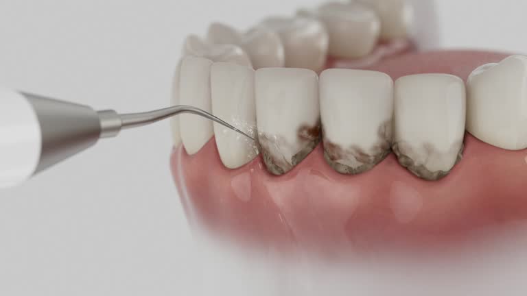 Trusted Dental Implants service in Carthage, MO - Dentist Open Now